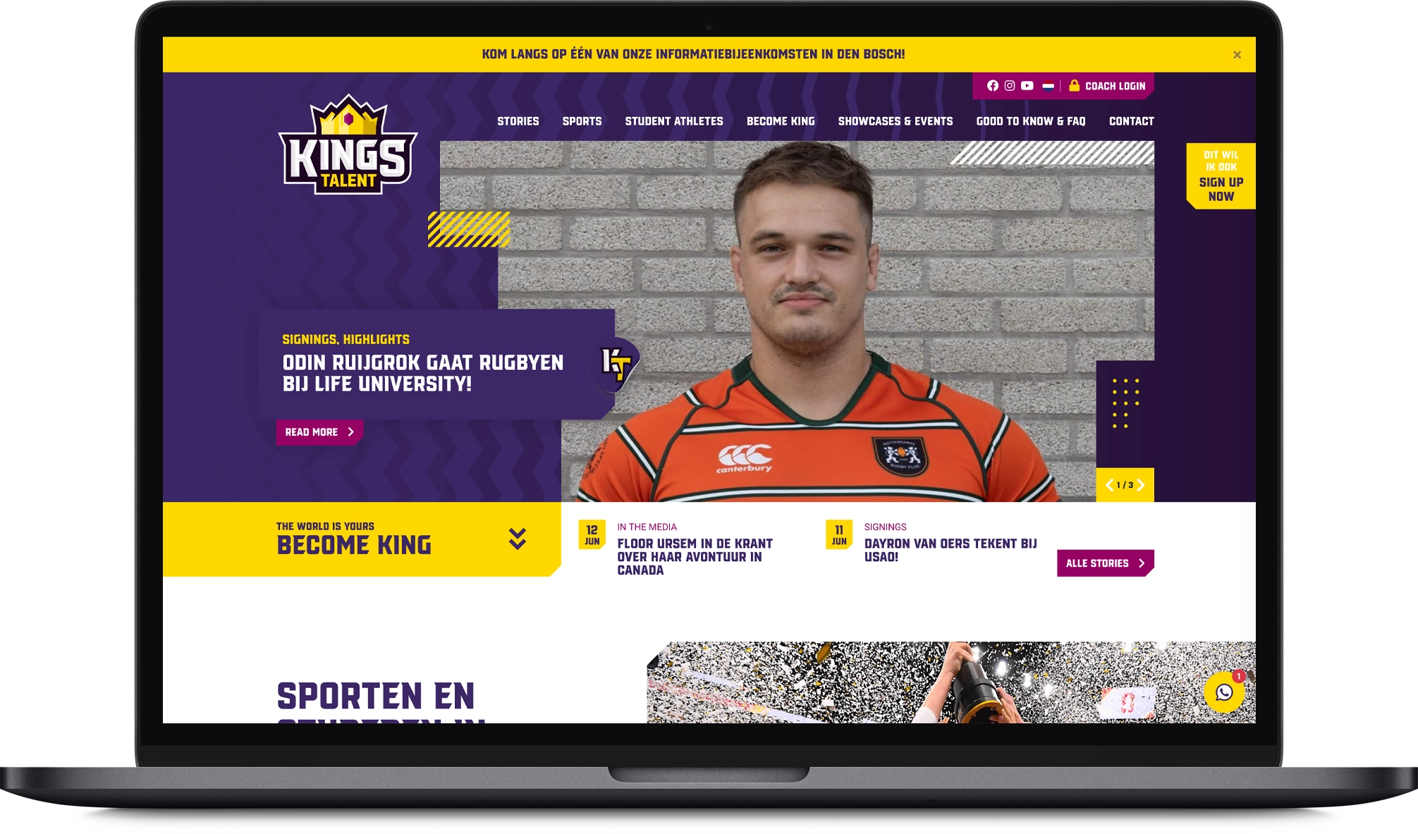 Spits-Visual-Kings-Talent-Laptop